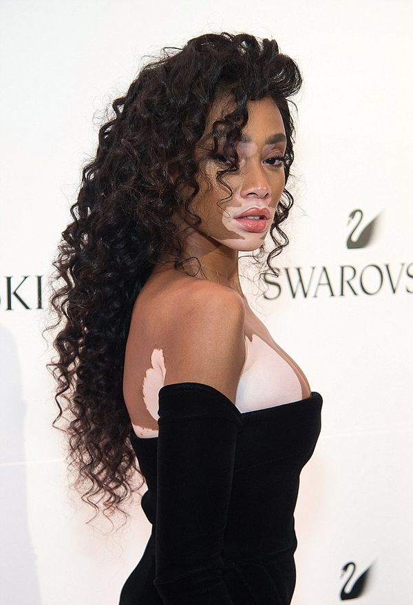 Модель Winnie Harlow